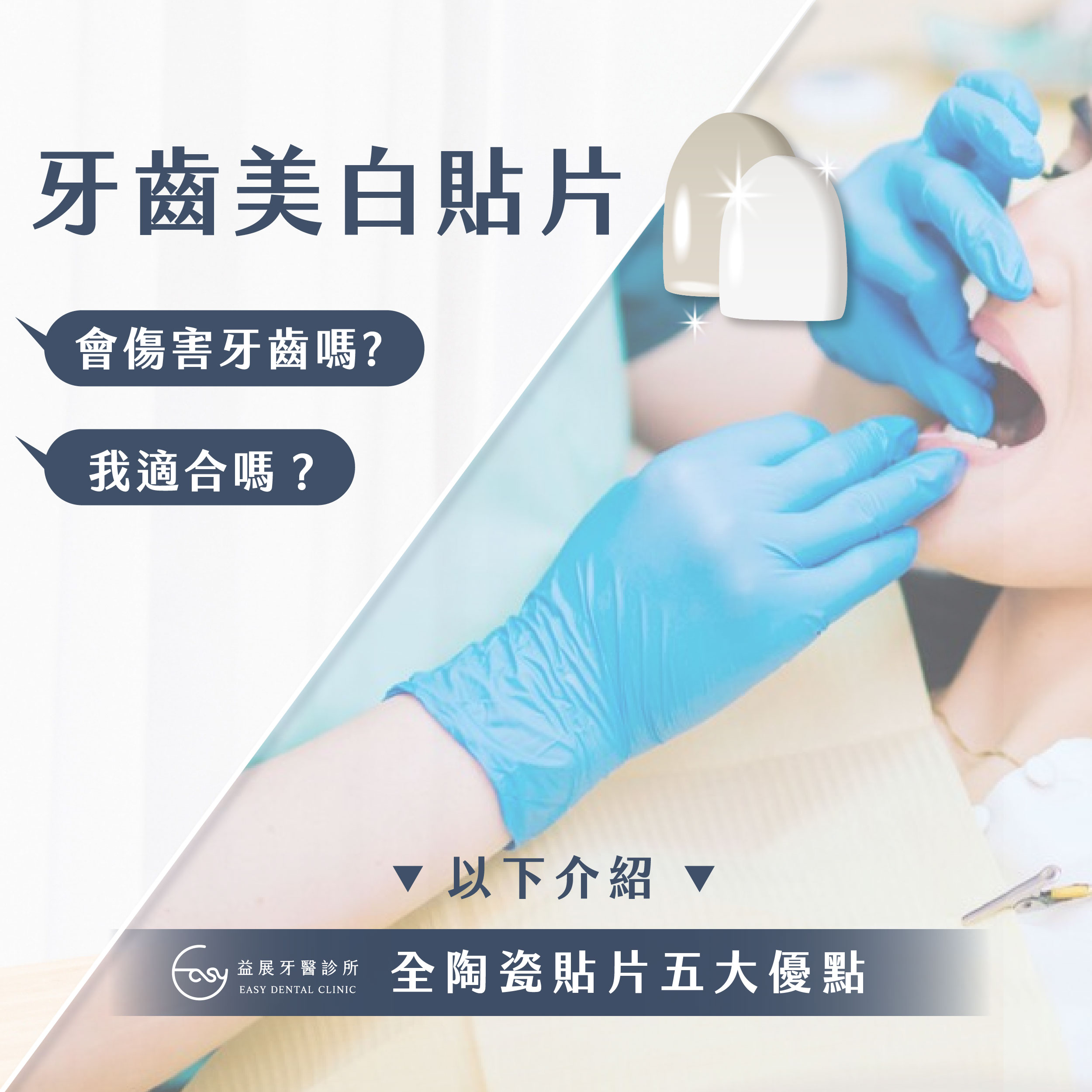 牙齒美白貼片適合我嗎？