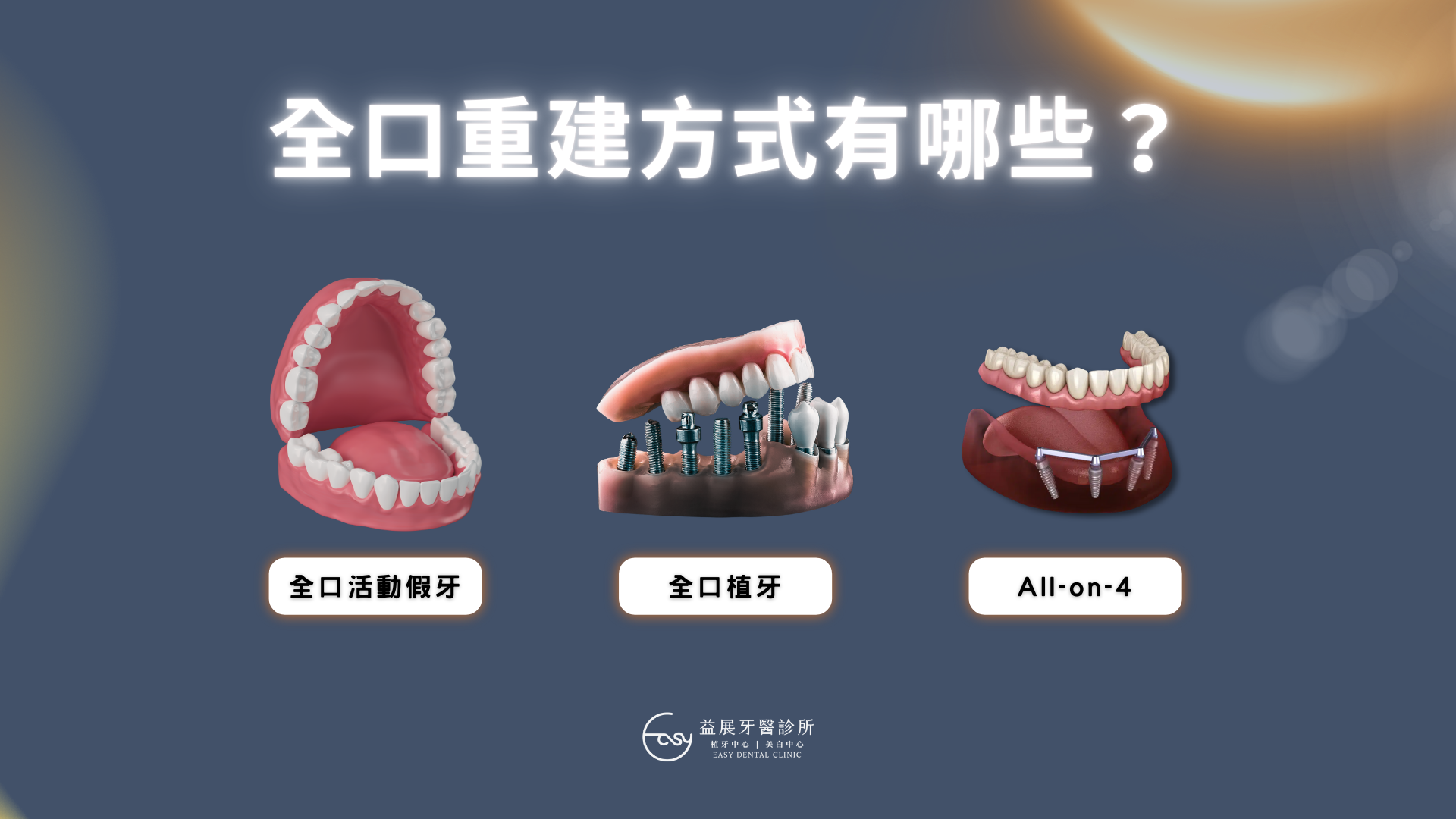 全口重建費用揭密！3種補牙方式價格比較