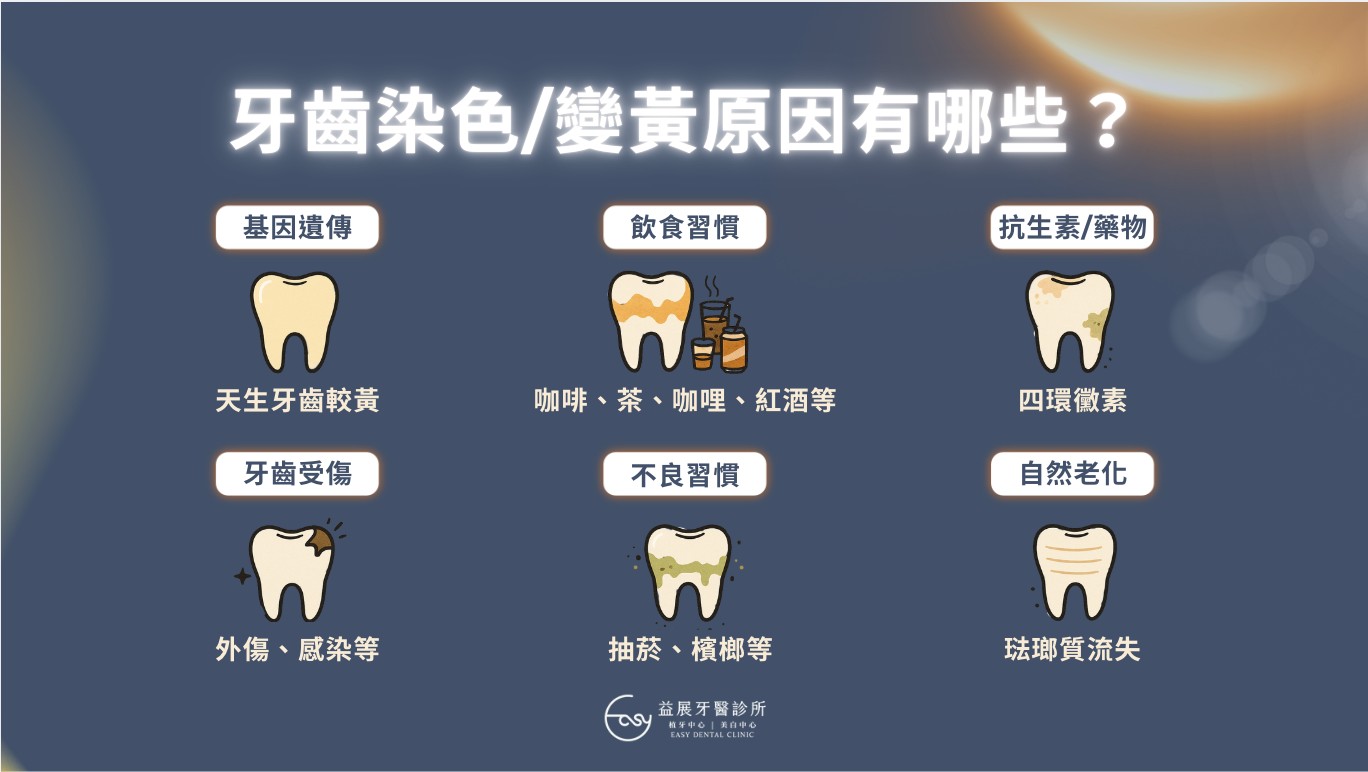 牙齒好黃？牙齒美白四大種類怎麼選？美白懶人包一次全介紹