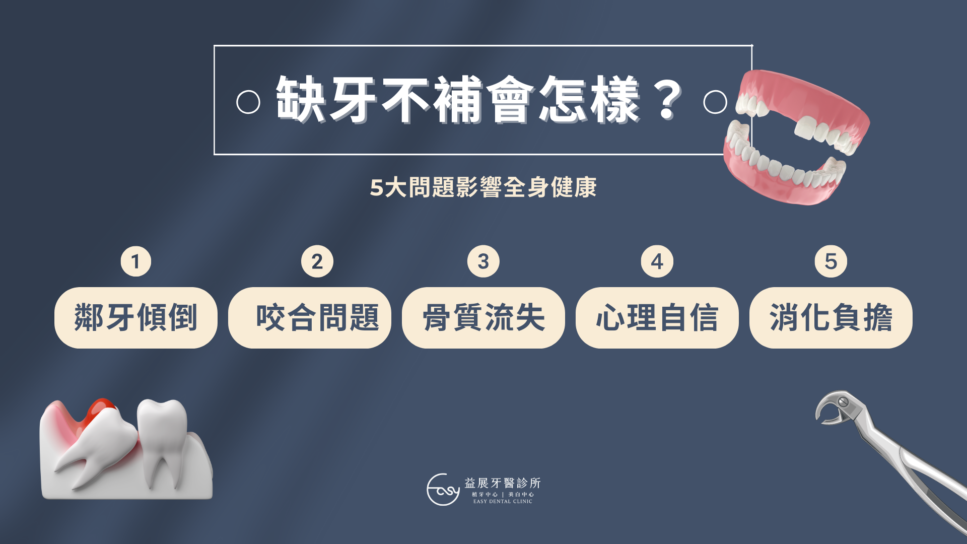 缺牙沒補會怎樣？缺牙的5大問題有哪些？我適合全口重建嗎？