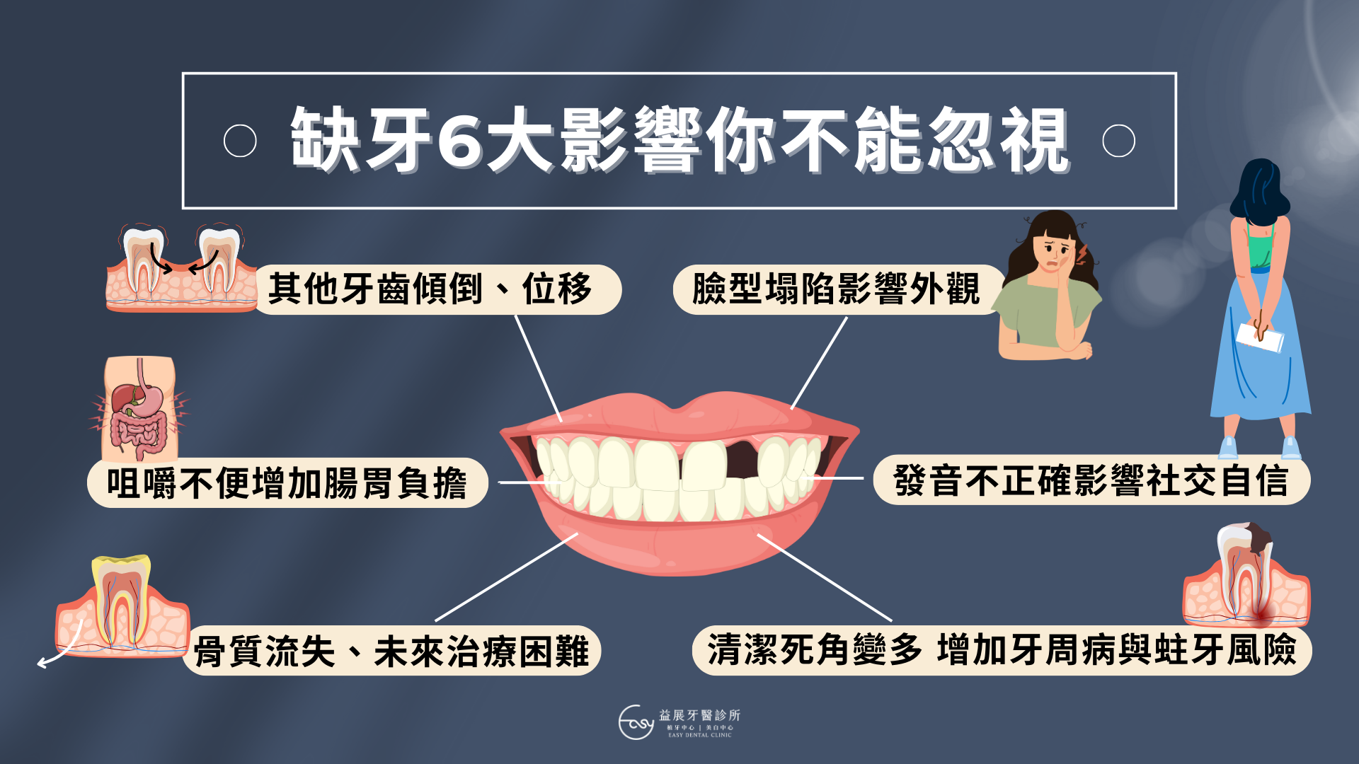 牙齒掉了怎麼辦？除了植牙、缺牙後你可以這樣做